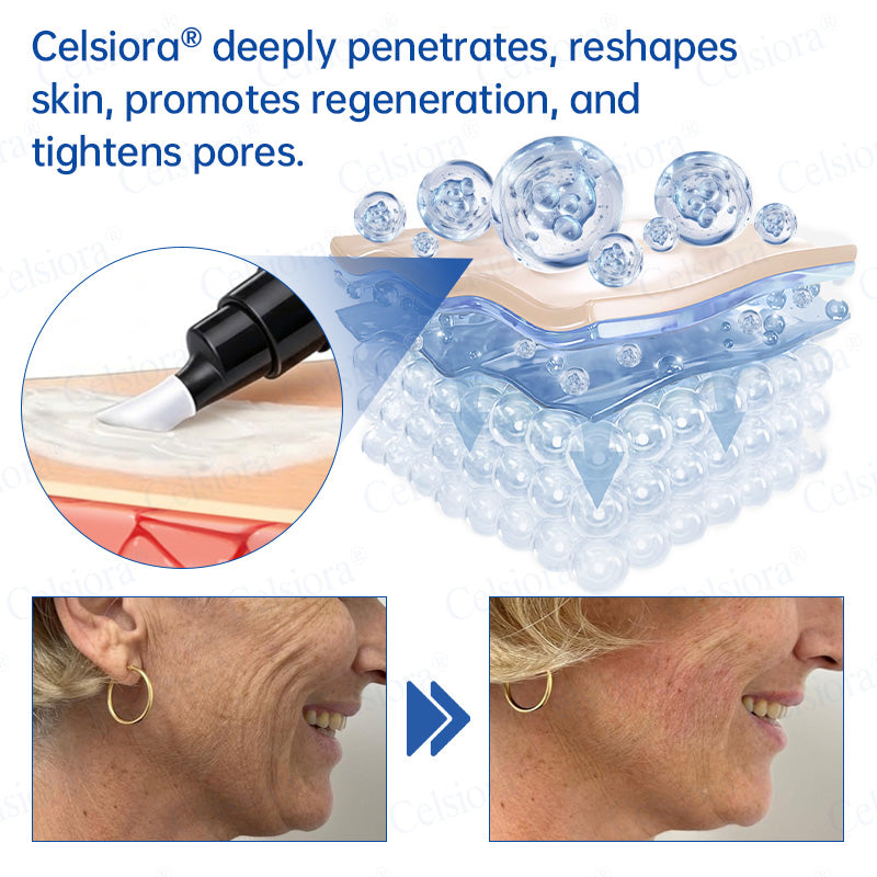 🥈🏆UK HOT SALE Celsiora® PDRN Anti-Wrinkle Shot – Lift & Firming Cream