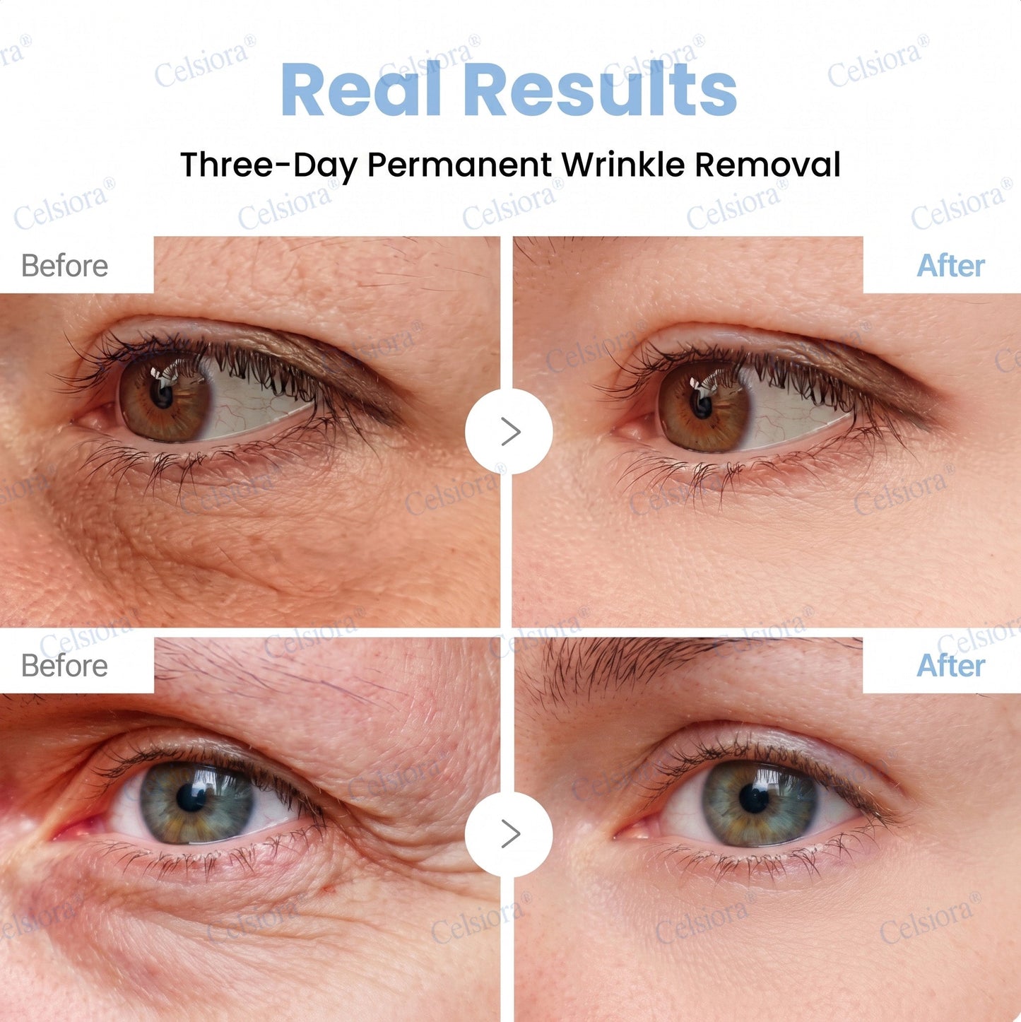 🥈🏆UK HOT SALE Celsiora® PDRN Anti-Wrinkle Shot – Lift & Firming Cream