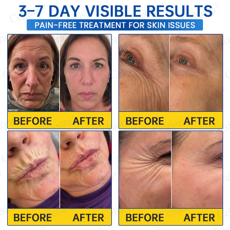 🥈🏆UK HOT SALE Celsiora® PDRN Anti-Wrinkle Shot – Lift & Firming Cream